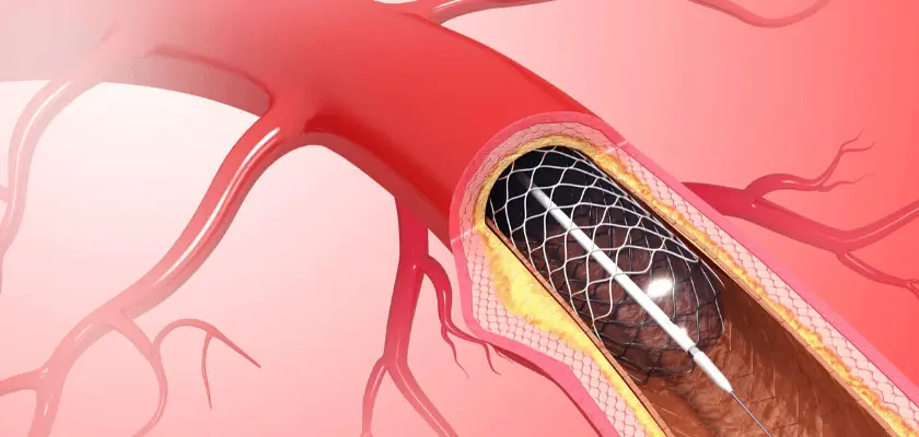 coronary artery disease and medications